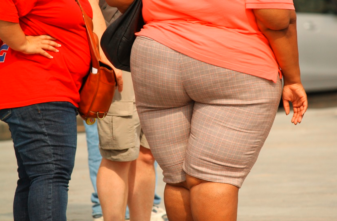 obezita žena